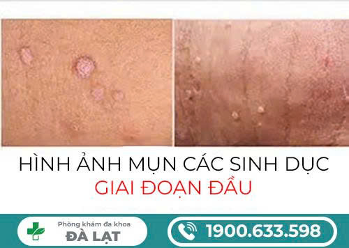 Hình ảnh minh họa